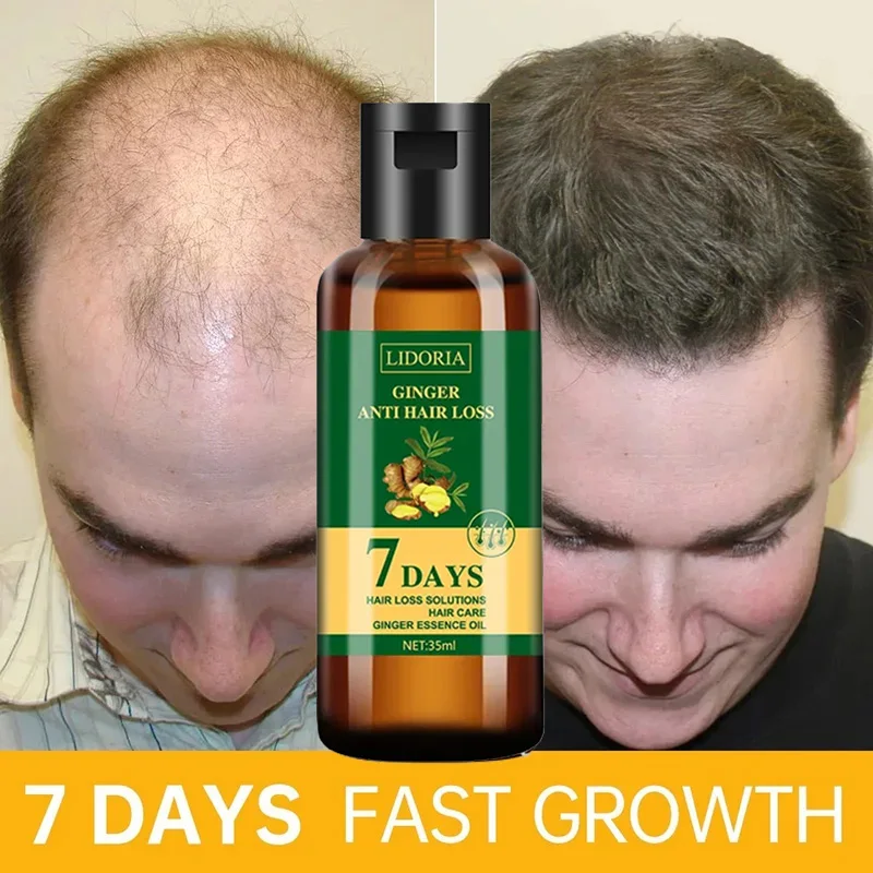 Hair Care Essential Oil Atomizing - Имбирная ткань против выпадения волос, сыворотка