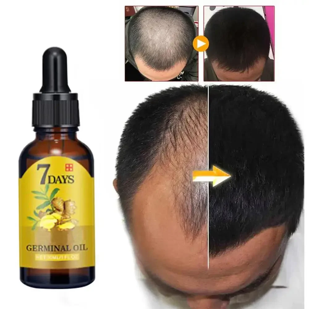 Hair Care Essential Oil Atomizing - Имбир для роста волос, эфирное масло