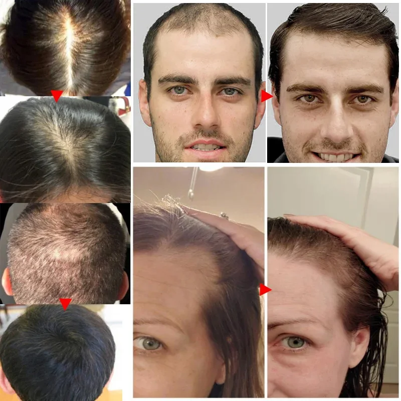 Имбирная ткань против выпадени – обзор и цена Hair Care Essential Oil Atomizing