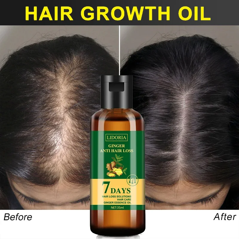 Имбирная ткань против выпадени – обзор и цена Hair Care Essential Oil Atomizing