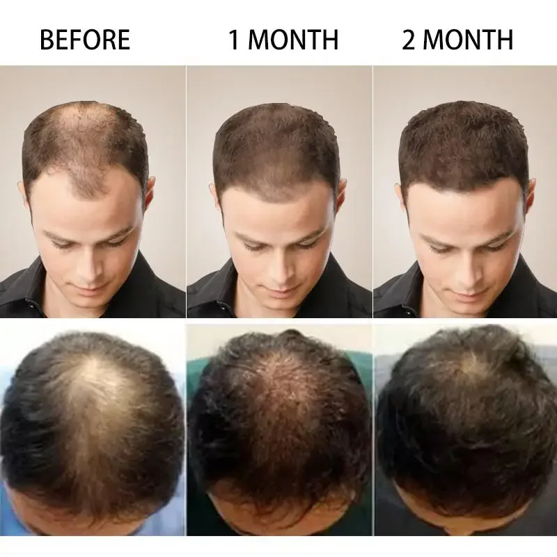 Имбир для роста волос, эфирное – обзор и цена Hair Care Essential Oil Atomizing
