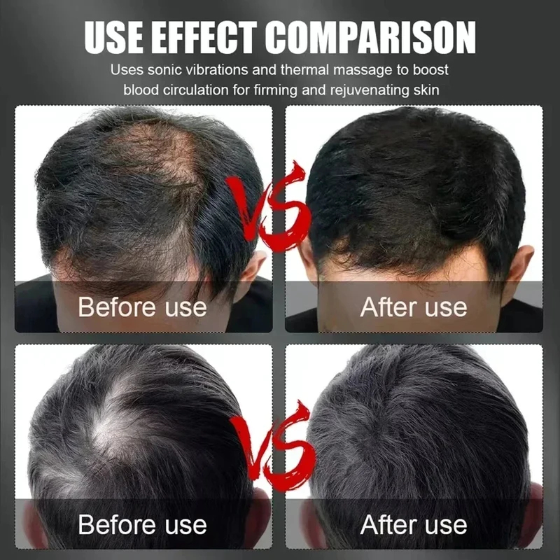 Шапка для терапии волос красны – обзор и цена Hair Care Growth
